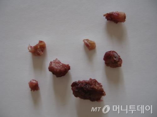 커달 이미지