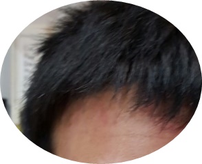 이끼마루 이미지