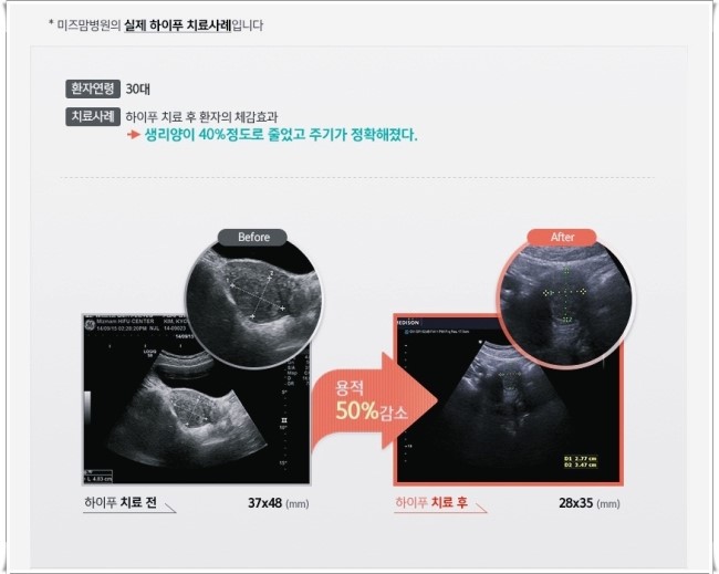 미즈맘의원 이미지