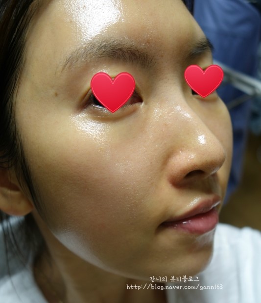 베네핏 에스테틱 이미지
