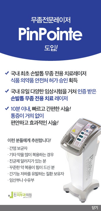 핀포인트 이미지