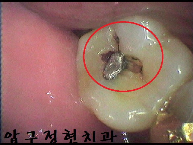 정현치과 이미지