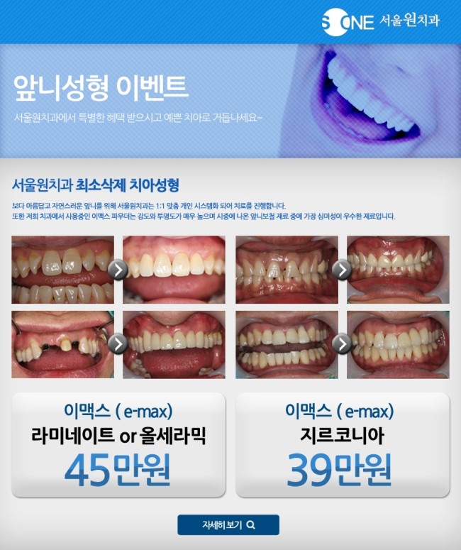 서울원치과 이미지