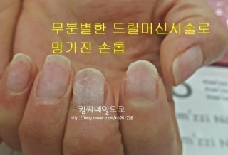 샤네일 이미지