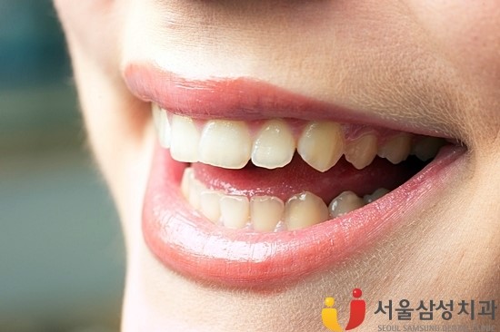 서울삼성치과 이미지