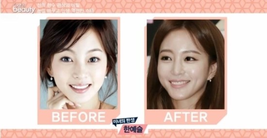 영구언니 이미지