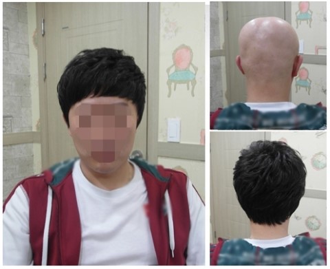 심는가발 이미지