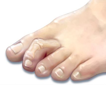 삼성바른신경외과 이미지