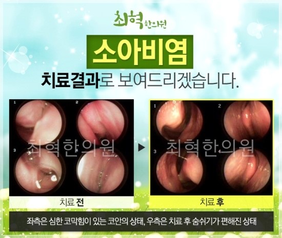 최혁한의원 이미지