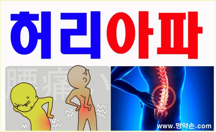 명약손 이미지