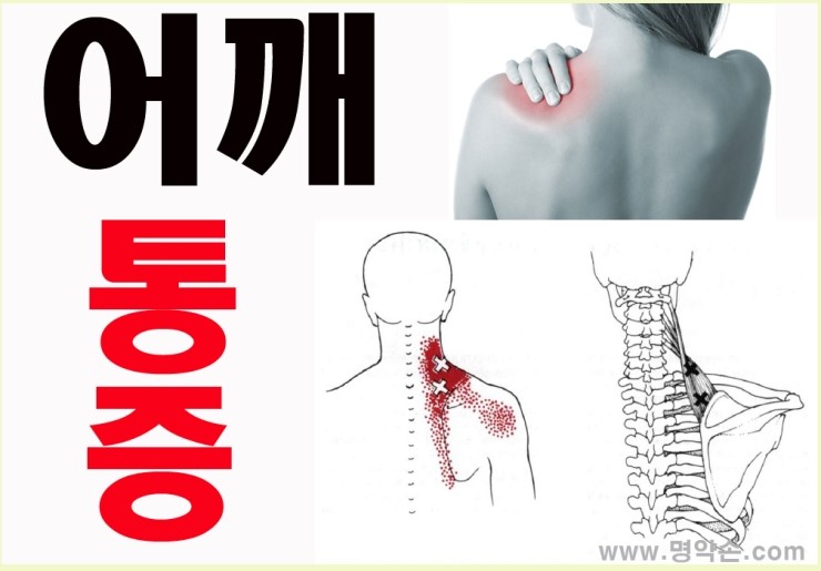 명약손 이미지