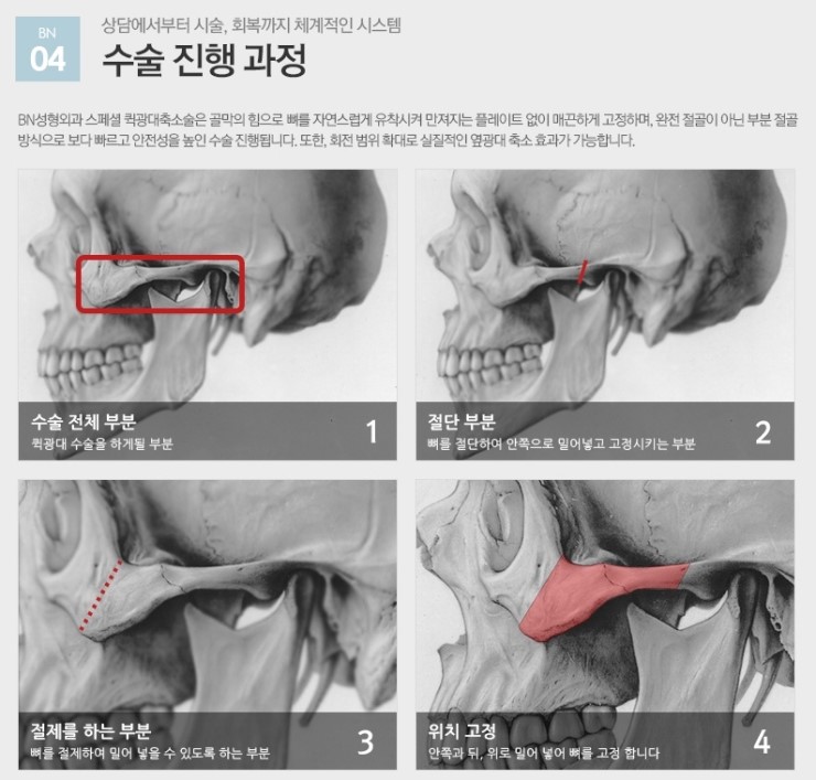 비엔성형외과의원 이미지