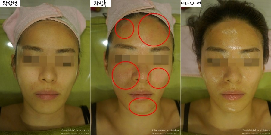 피부미인스킨케어 이미지