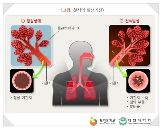 은정세탁 이미지