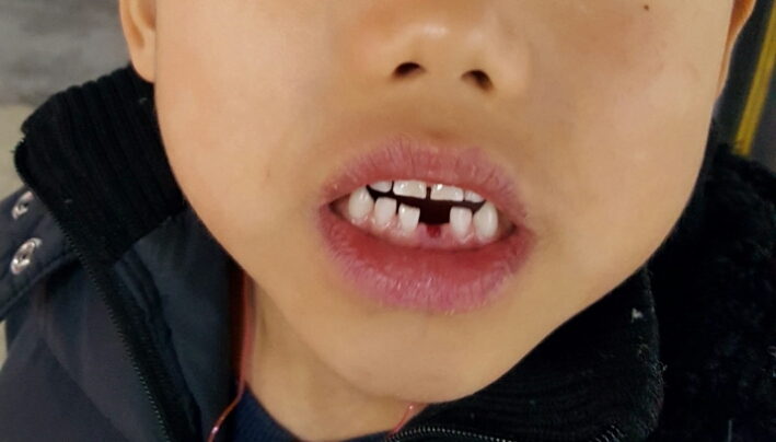 어린왕자치과 이미지