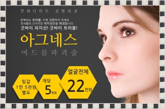 아그네스 이미지