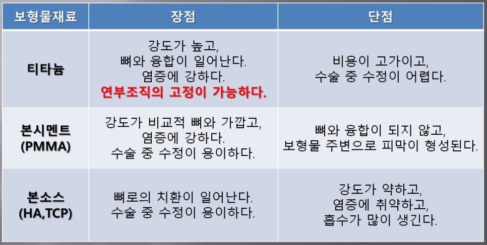 티타늄·PMMA·본소스 3D Fit 광대 재건 재료 비교표