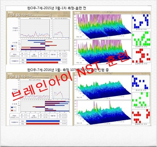 뉴로사운드 이미지