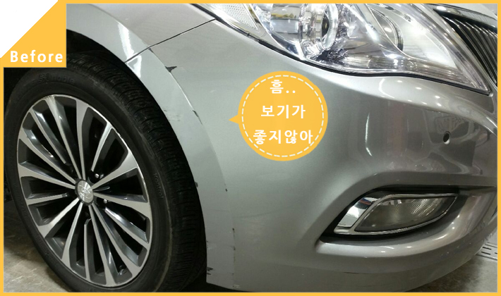 현대덴트칼라 이미지