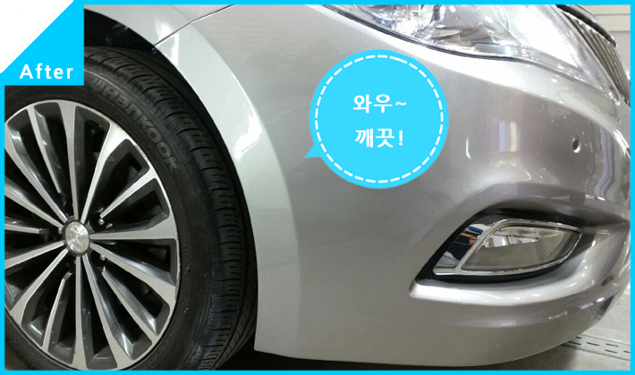 현대덴트칼라 이미지