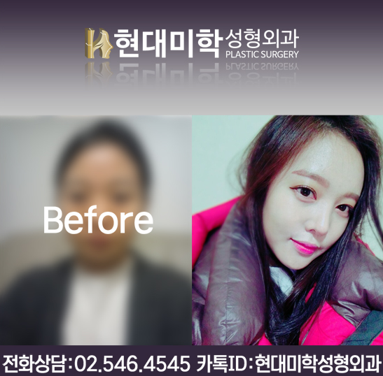바로여다 이미지