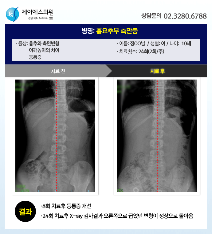 제이에스의원 이미지