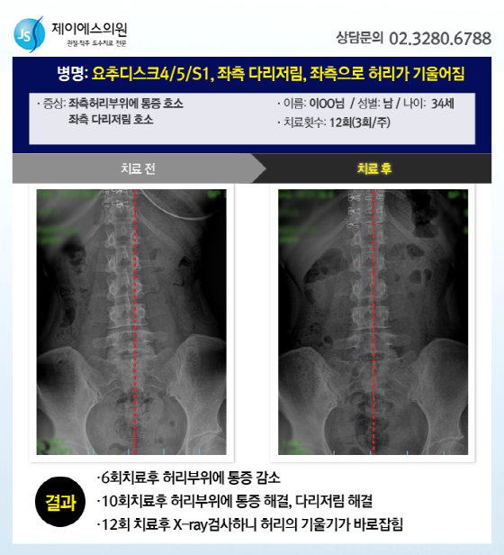 제이에스의원 이미지