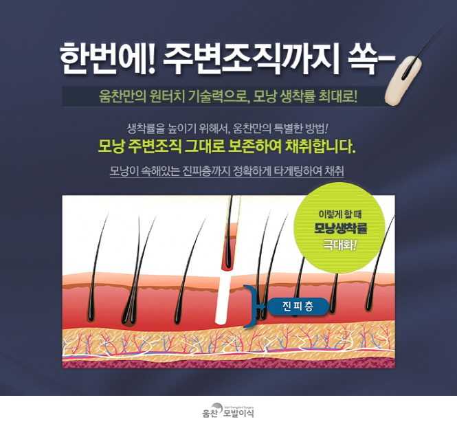 움찬 이미지