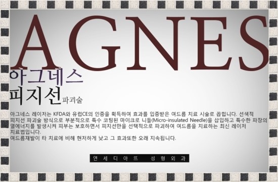 아그네스 이미지