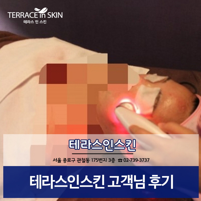 테라스 인 스킨 이미지