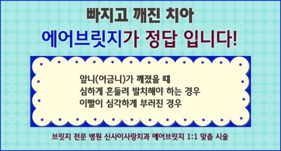 이브릿지 이미지