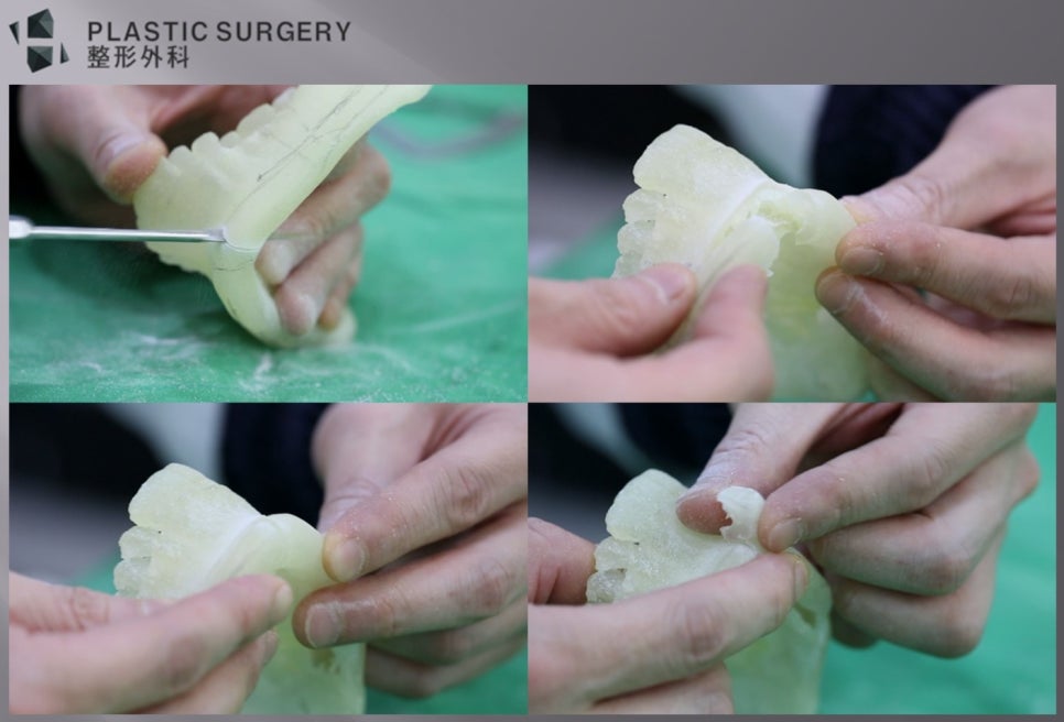 3D 프린팅 하악골 모형으로 시행한 턱끝 T절골 모의수술