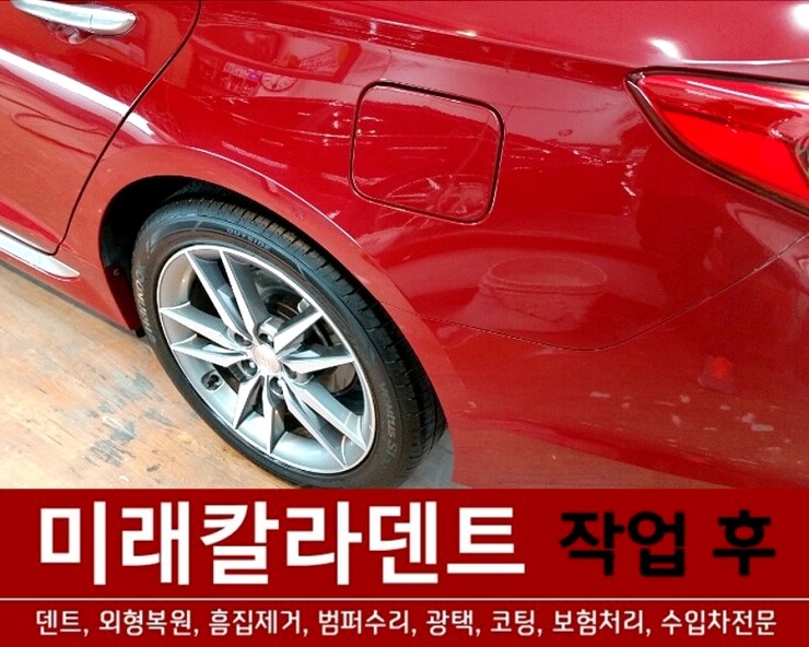 미래덴트칼라 이미지