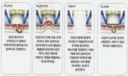 미오플러스 이미지