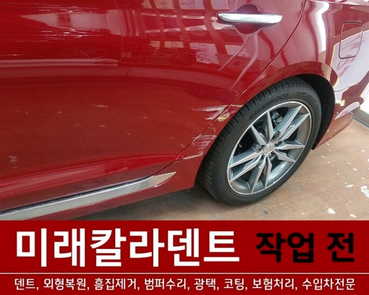 미래덴트칼라 이미지