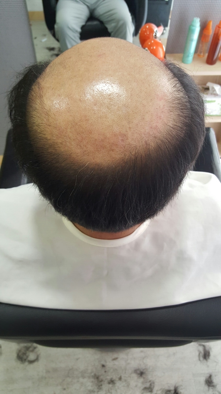 영모가발 이미지