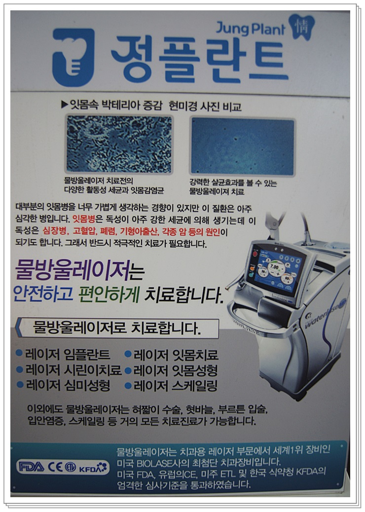 플란트열 이미지