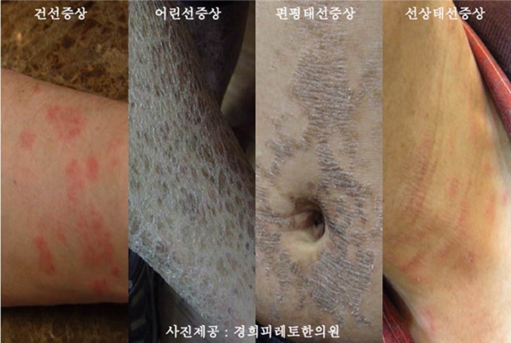 경희광택 이미지