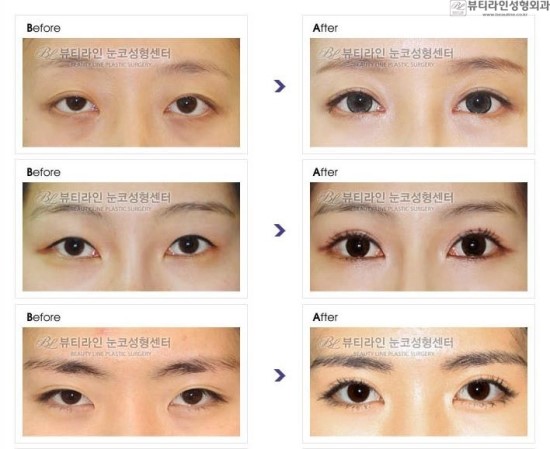 뷰티라인 이미지