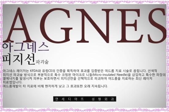 아그네스 이미지