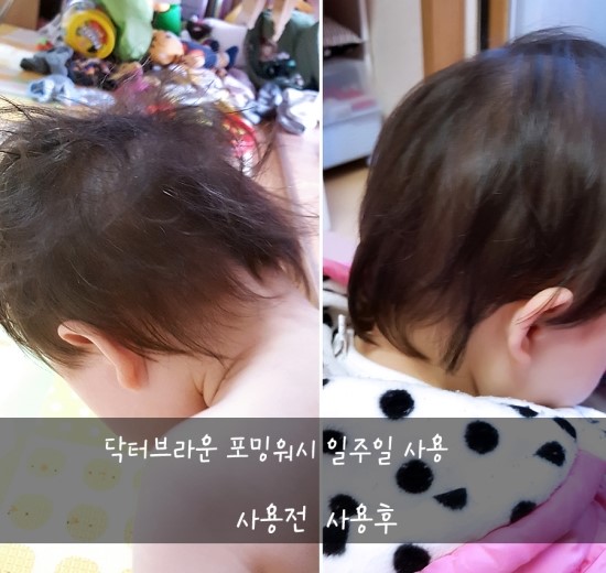 닥터워시 이미지