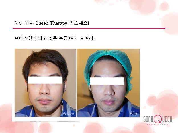 퀸테라피 이미지