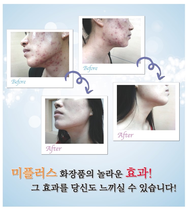 미플러스화장품 이미지