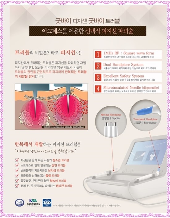 아그네스 이미지