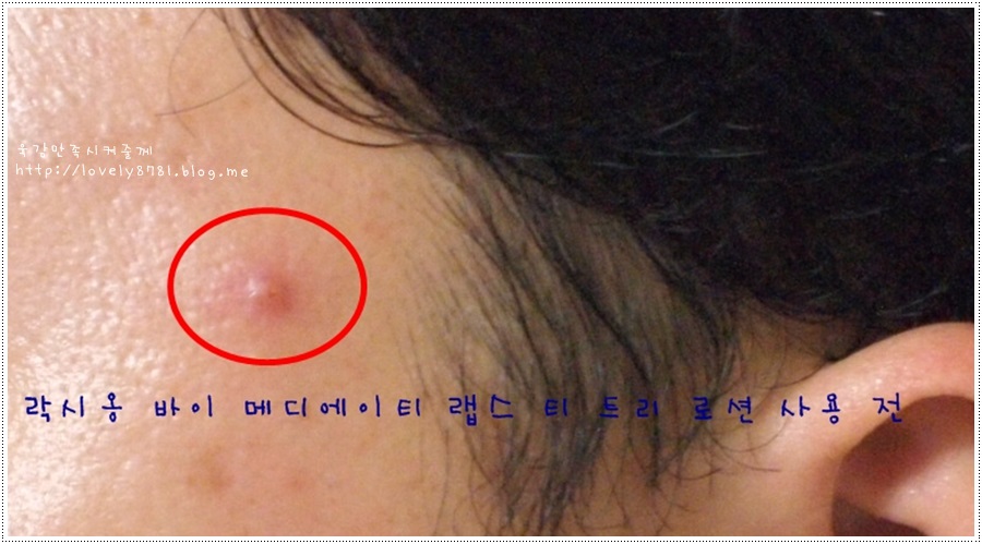 에이틱 이미지