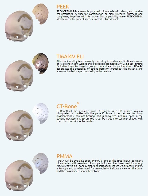 환자 맞춤 3D 프린팅 임플란트 서비스를 소개한 자료