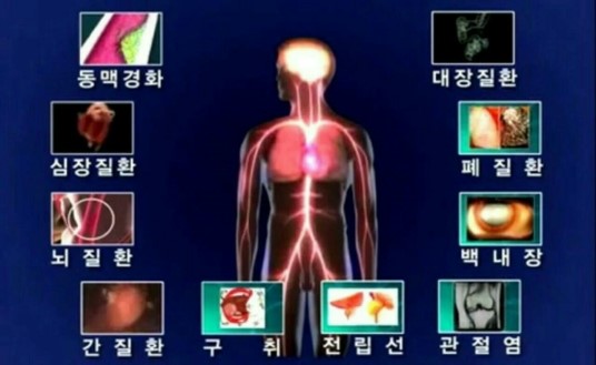 플로렉스 이미지