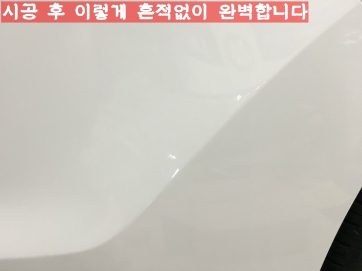 덴트젠 이미지