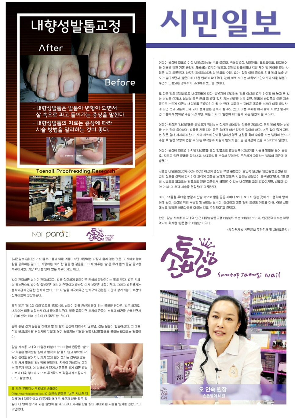 손톱쟁이 이미지