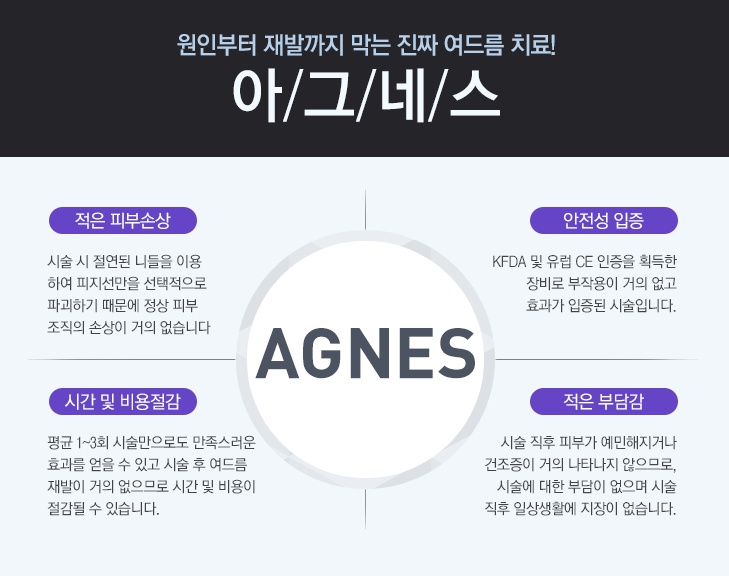 아그네스 이미지
